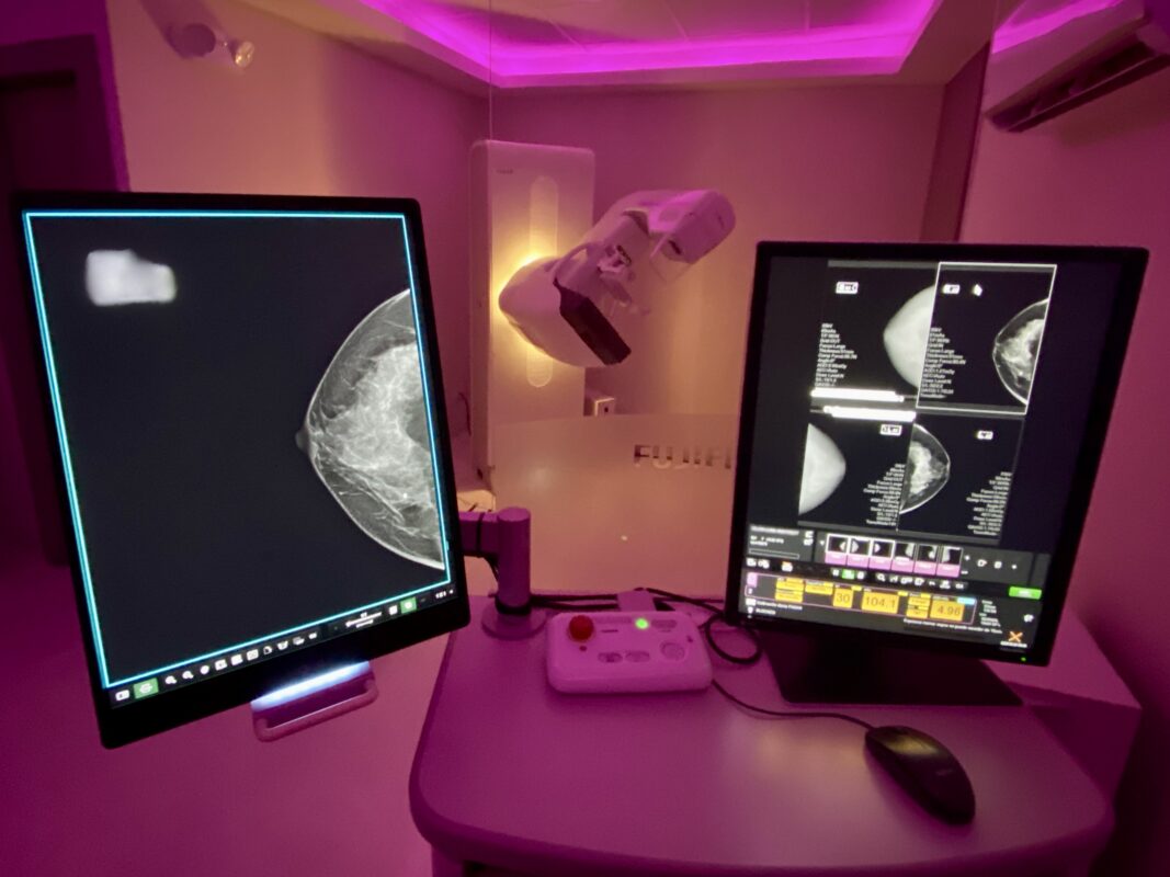 More women are dying from breast cancer in Tamaulipas — just miles away, survival looks very different